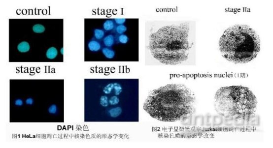 常用的几种细胞凋亡检测方法详细步骤(一)