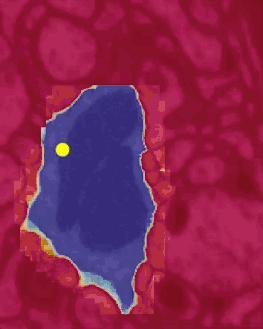 在2D中分割物体的Flood-Filing网络。黄点是当前焦点区域的中心；随着算法不断迭代，检查整个图像，分割区域不断扩展（蓝色）。
