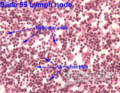 网状细胞(图1)