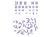 细胞染色体核型分析G-显带