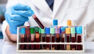 临床-验血-样本分析
